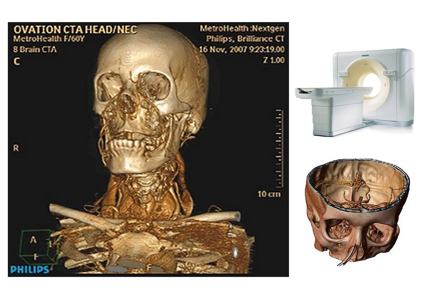 PHILIPS CT Tech
